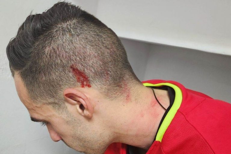 Ξυλοφόρτωσαν τους διαιτητές στο Δασάκι… (φωτογραφίες)